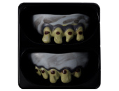 Зубы гнилые (уп2)